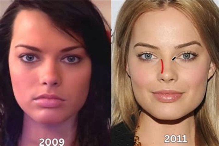 Corinna Kopf Plastic Surgery | Before And After Photos
